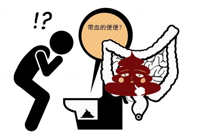 肠道功能紊乱|肠道生病,身体会发出警示!若有3个异常,最好排查肠道疾病