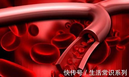 主动脉|北京古楼疑难病研究院肿瘤科于加军:主动脉瘤症状有哪些?