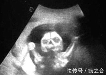 肚子|B超下!肚子里的婴儿竟朝母亲露出凶相