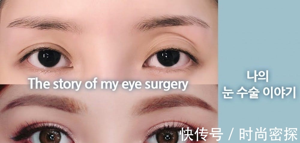 双眼皮 美妆教主Pony大方坦承整形两次!术后跟粉丝分享“术前VS术后”!