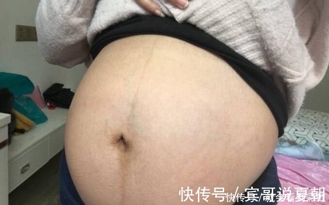 凹凸|怀孕后孕妇从这周开始显怀，如果肚脐没有这种表现，说明很有福气