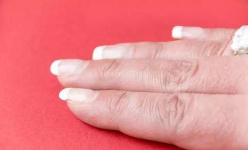 黄芪|女人气血不足,“指甲”先知道?医生:6物敞开吃,气色越来越好