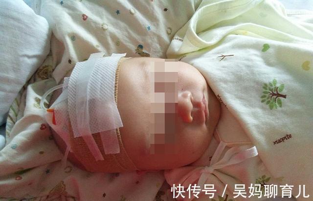 降温|宝宝体温异常,发烧了怎么办?别慌,先分清是不是病理性再做措施