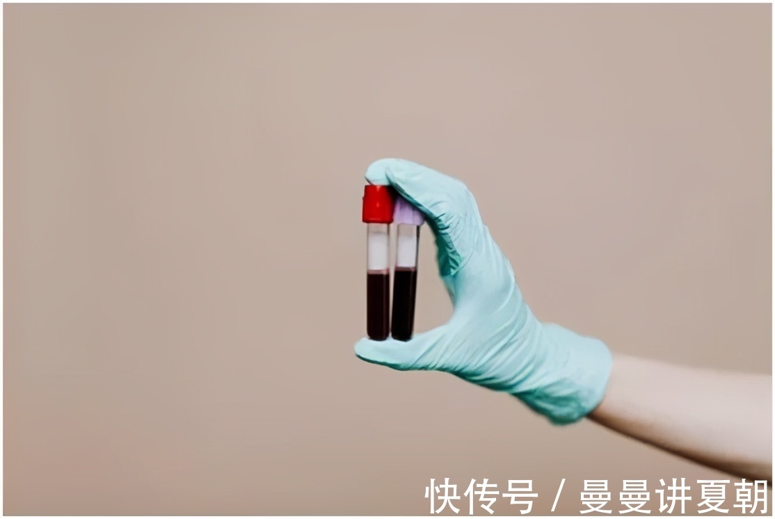 急性|这些炎症可能比癌症更可怕,发病快、致死率高