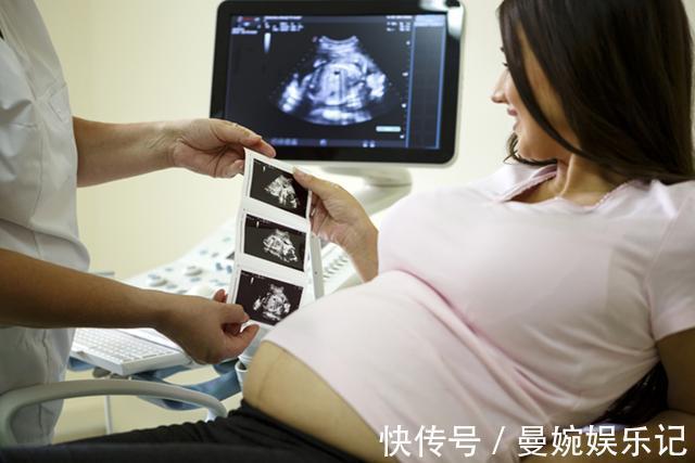 团子妈|为什么胎儿周围的液体叫“羊水”,而不是“人水”呢?答案在这里