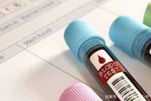 身边的高嘌呤食物不少？其中有4种或比猪肉的嘌呤高，尽量少吃