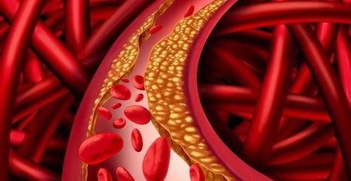 高脂蛋白血症|生花生和熟花生，哪个更营养？医生：5类人最好少碰，别不当回事