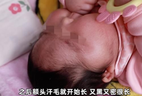 大v|“大头娃娃”再次出现,额头长满汗毛,这次是“毒护肤霜”惹的祸