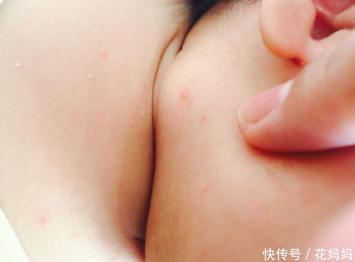 婴儿|“消”字号婴儿霜,致5个月宝宝全身发胖,发育迟缓,脸上长毛