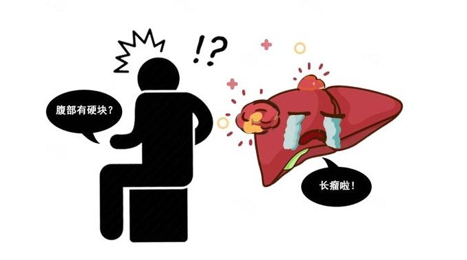 患者|肝癌发出的第一个信号，很多人以为小病，3类人最好做CT排查一下