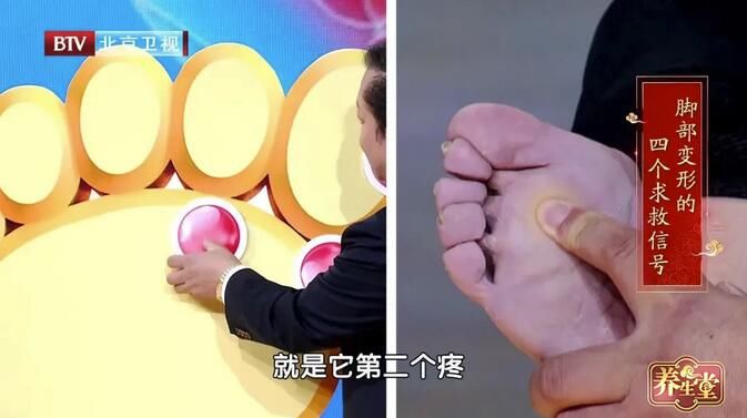 鞋底|足部变形的四个求救信号，需要多注意