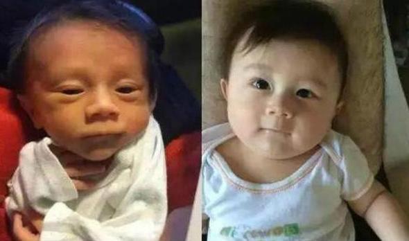 真香|“黑脸宝宝”出生后被嫌弃,2月后却逆袭成“团宠”,宝爸:真香