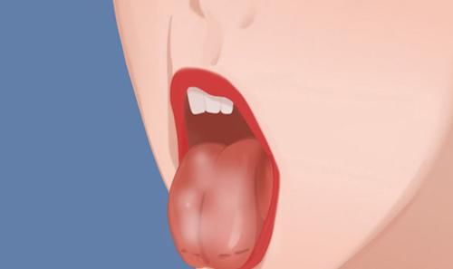 五脏健康都写在舌头上了，舌苔厚重、发黄究竟是怎么回事？