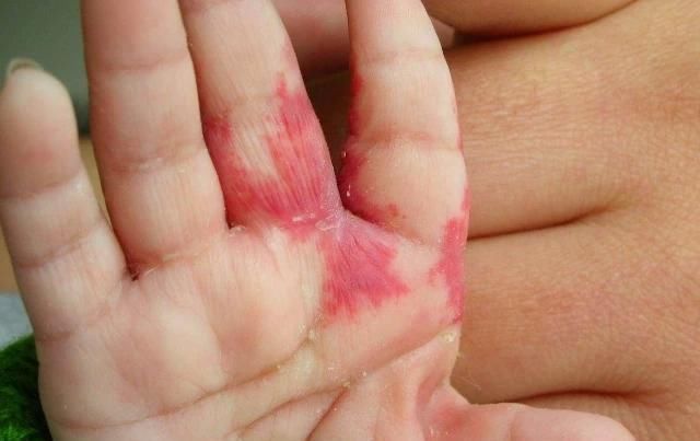 诱人|孕妈在孕期,尽量不做4件事,避免宝宝脸上长胎记,孕妈别不在意