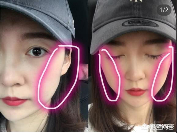 日常生活有什么瘦脸的方法，推荐几个