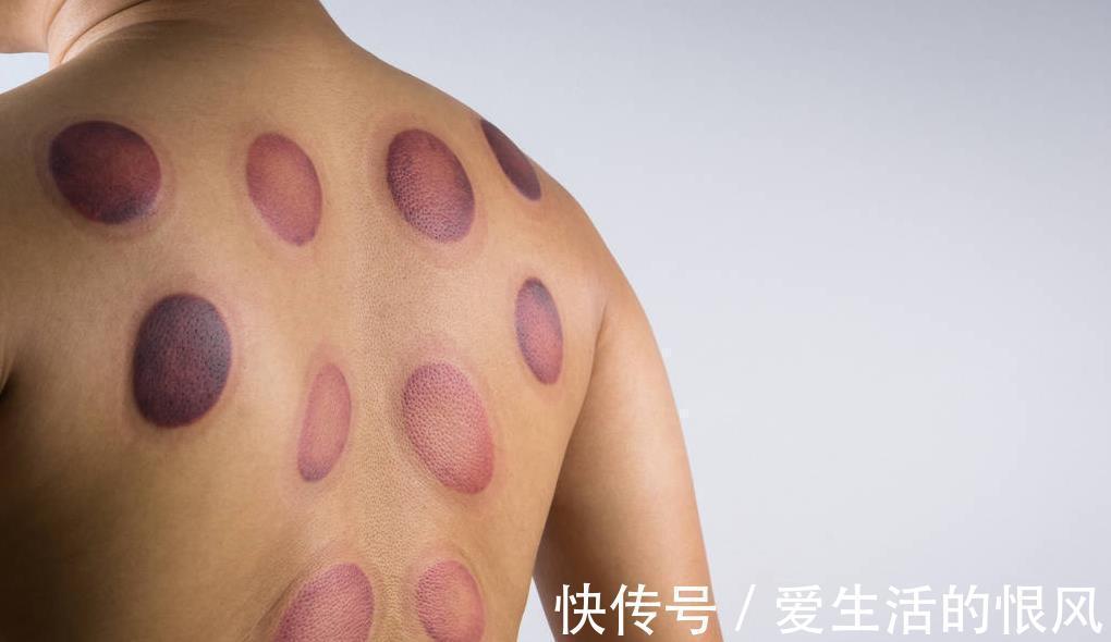 胆固醇|中医提醒:很多你以为的“好习惯”,其实正悄悄摧毁健康,别信