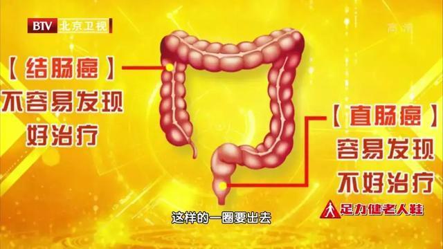 直肠癌|全新抗癌疗法！直肠癌中晚期，不开刀，肿瘤细胞竟然完全消失了