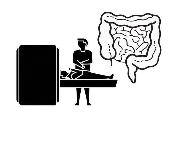 患者|得了直肠癌还有救？医生：关于直肠癌的4种治疗方式，不妨了解下