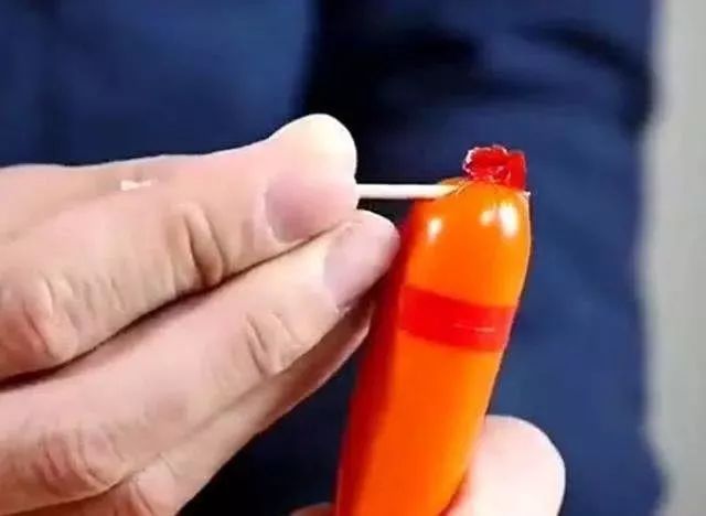 硕参|26岁女子,肠道内长满肿瘤,再次提醒3种食物,少往嘴里塞