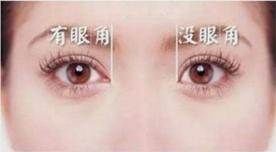 开眼角有什么后遗症？