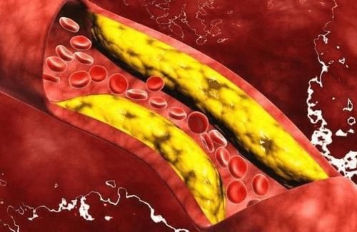 活动度|经常走路可以长寿吗?医生:过了50岁,坚持做3件事比运动还重要