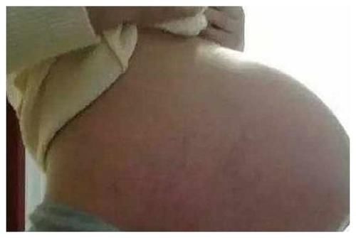 孕妇|孕妇身体如果出现这些感觉,证明宝宝开始发动了,恭喜快熬出头了