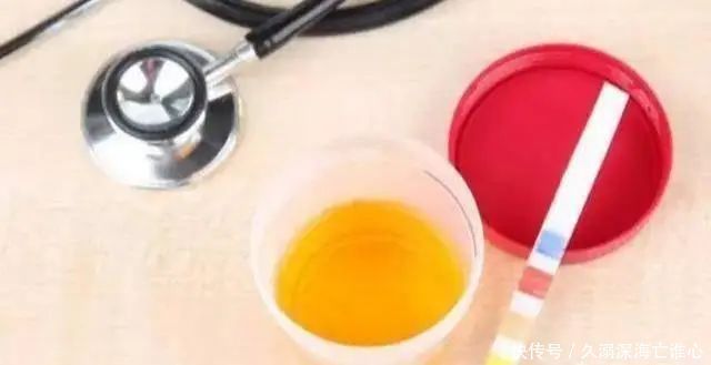 70-79岁是“长寿关键期”,想要更健康,谨记3防,4勤