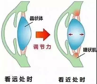 远视|佩戴老花镜的常见误区，避免老花眼加深，提高生活质量~