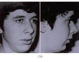 牙齿|牙齿三个 “关键期” ,千万别错过!否则毁掉孩子一口好牙