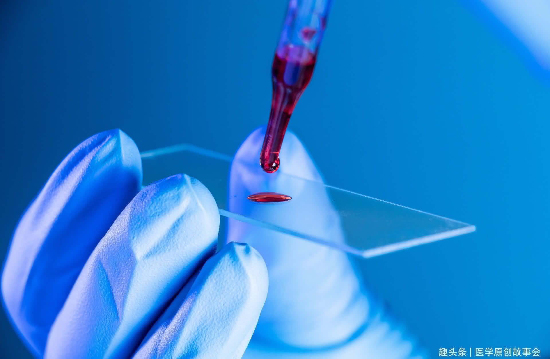 血型决定寿命?A型、B型、O型、AB型,哪种癌症发生率最高?