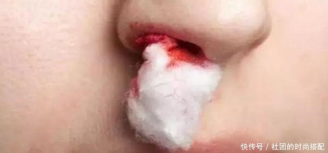 年纪|52岁男子,突发脑溢血,医生痛斥都这把年纪了,2件事早该控制