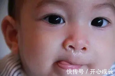 腹泻|换季易生病,乳铁蛋白增强宝宝的抵抗力!