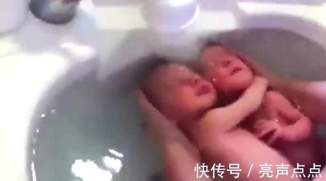 小家伙|双胞胎哥俩被剖腹抱出,哥哥以为有危险,一把将弟弟搂住!