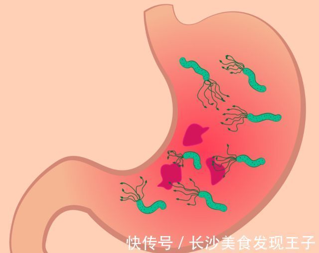 胆固醇|研究胃病六十多年，88岁院士总结出3张“养胃处方”，分享给你