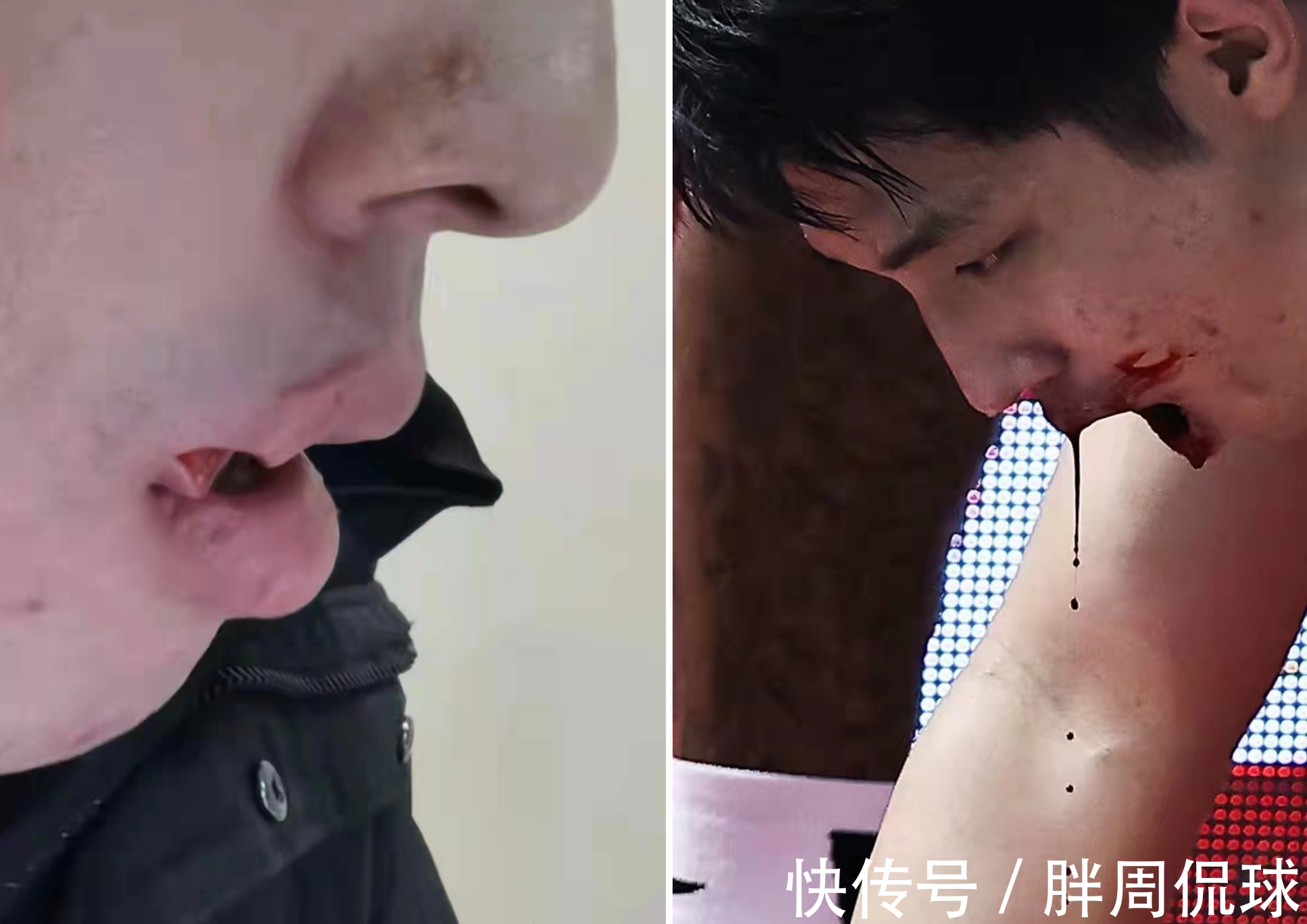 苏伟|血流满面!任骏飞肘击对手送医缝12针,CBA联赛成宏远队武打场?