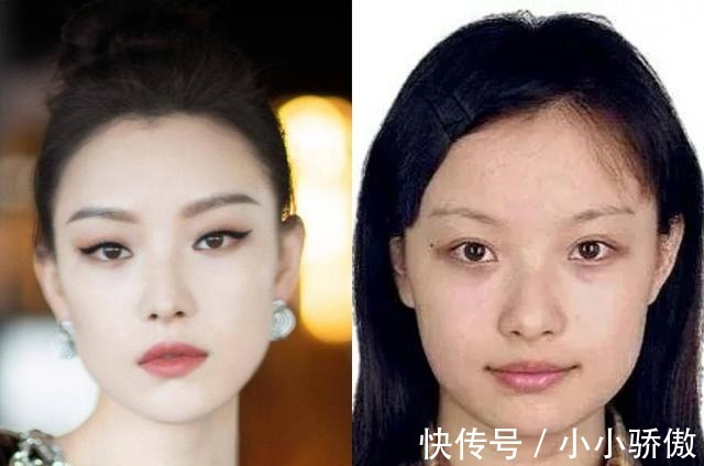 精准强脉冲光 每个都有变美的权利，那么哪些医美项目你都了解吗！