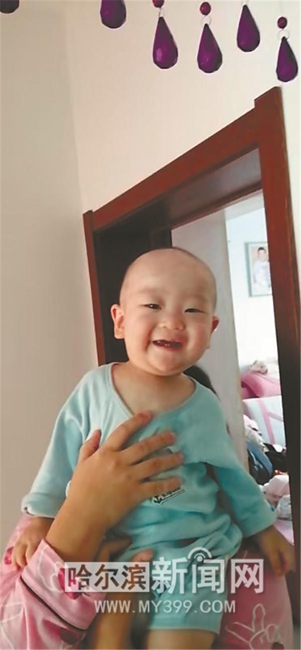 小喆目前|被烫伤的婴儿小喆出院了