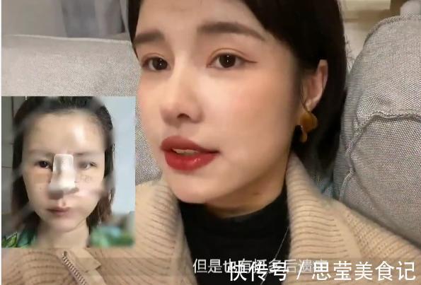 张轻轻|美女模特警告世人谨慎整容，自曝隆鼻后遗症：鼻孔流脓奇臭无比