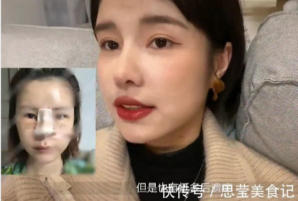 张轻轻|美女模特警告世人谨慎整容,自曝隆鼻后遗症:鼻孔流脓奇臭无比