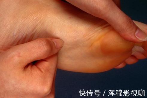 绿萝花|睡觉时，如果有这4个小毛病，很遗憾，你的血管可能已经出现血栓