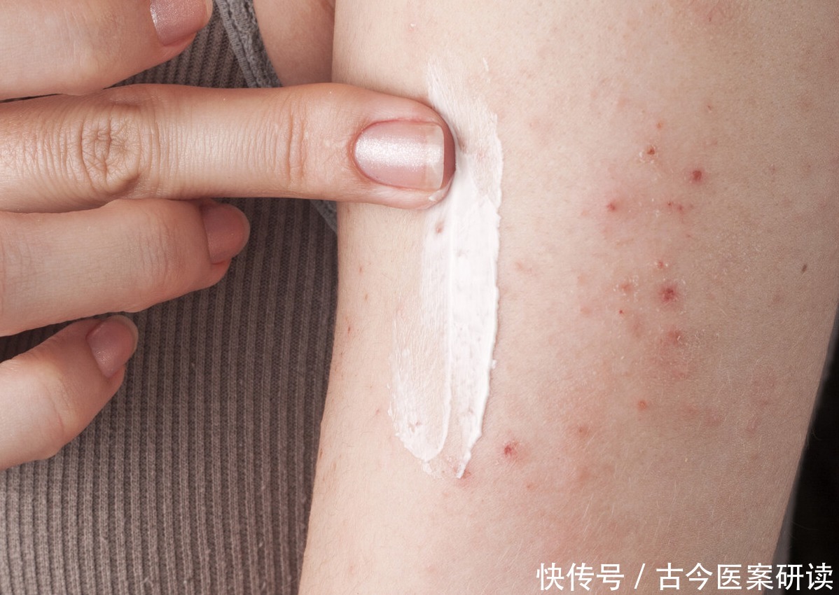 舒筋活络|老鹤草,老白鹤守护的“仙草”,全国各地都有长,常用于通经络