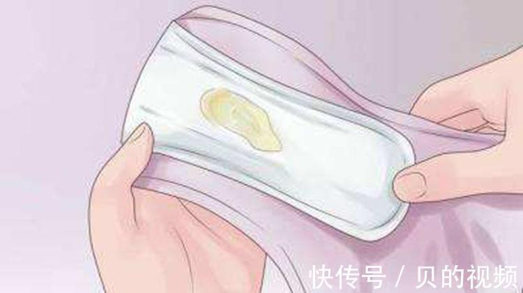 非排卵期|女人没有白带,身体会出现什么变化?白带消失的原因有哪些?