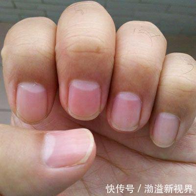 科学|指甲上没有月牙与指甲上有的人，谁身体更健康科学的解释来了