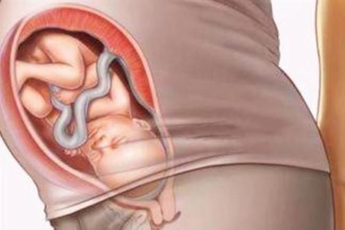 剖腹产|剖腹产划伤宝宝,宝妈声讨无果,若想避免,准妈妈要注意这几点