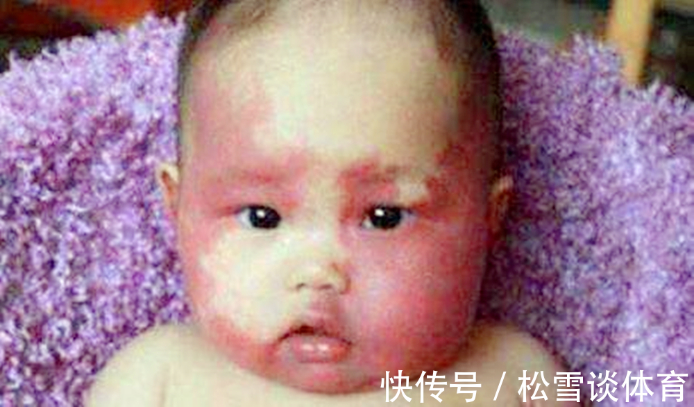 淡青色|孕期别干5件事,不然胎记找上宝宝,不然长大被孩子怨恨