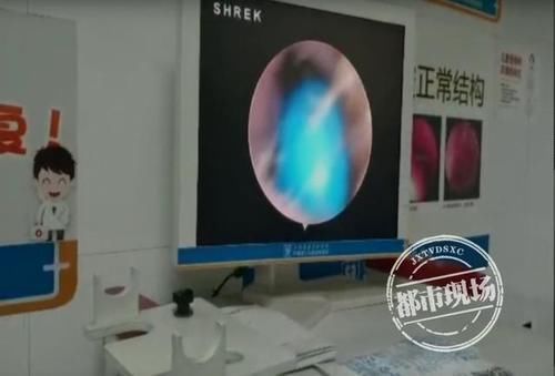 珠子|4岁女童鼻里塞珠子,妈妈竟自己掏,险些要了孩子的命