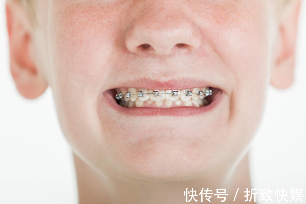 干预|儿童做牙齿矫正三个最佳时间家长要牢记,矫治越早干预效果越好