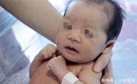 异状|27岁女子生孩子用力过猛出现这异状，切记分娩时一定要注意这三点