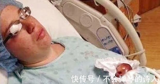 生命力|出生时仅25厘米的“拇指姑娘”,曾被断言活不过3月,却健康长大