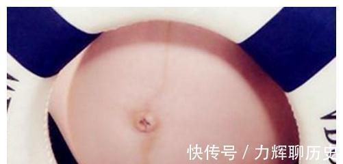 小王子|腹中是“公主”还是“王子”?孕期3个现象可能“透露”了答案!